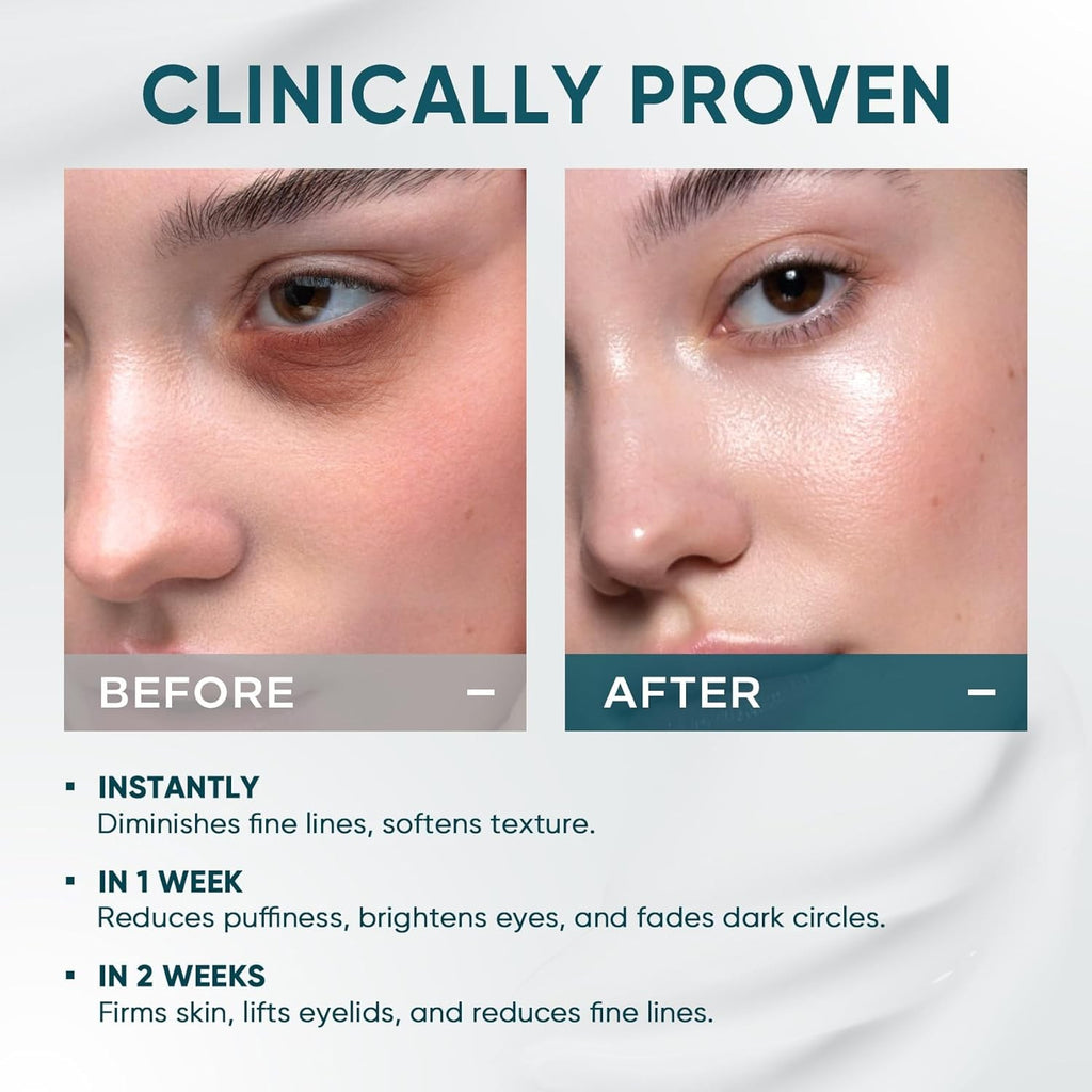 Dual Eye Cream for Dark Circles, Puffiness, Eye Bags, Wrinkles, Anti-Aging, Tigh