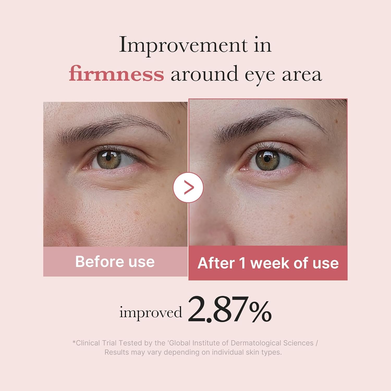 Eye Serum with Salmon DNA PDRN & Pink Peptides | 99% Purity Retinol for Fine Lines | PDRN & Niacinamide for Uneven Skin Tone | Korean Skincare, 1.01 Fl.Oz