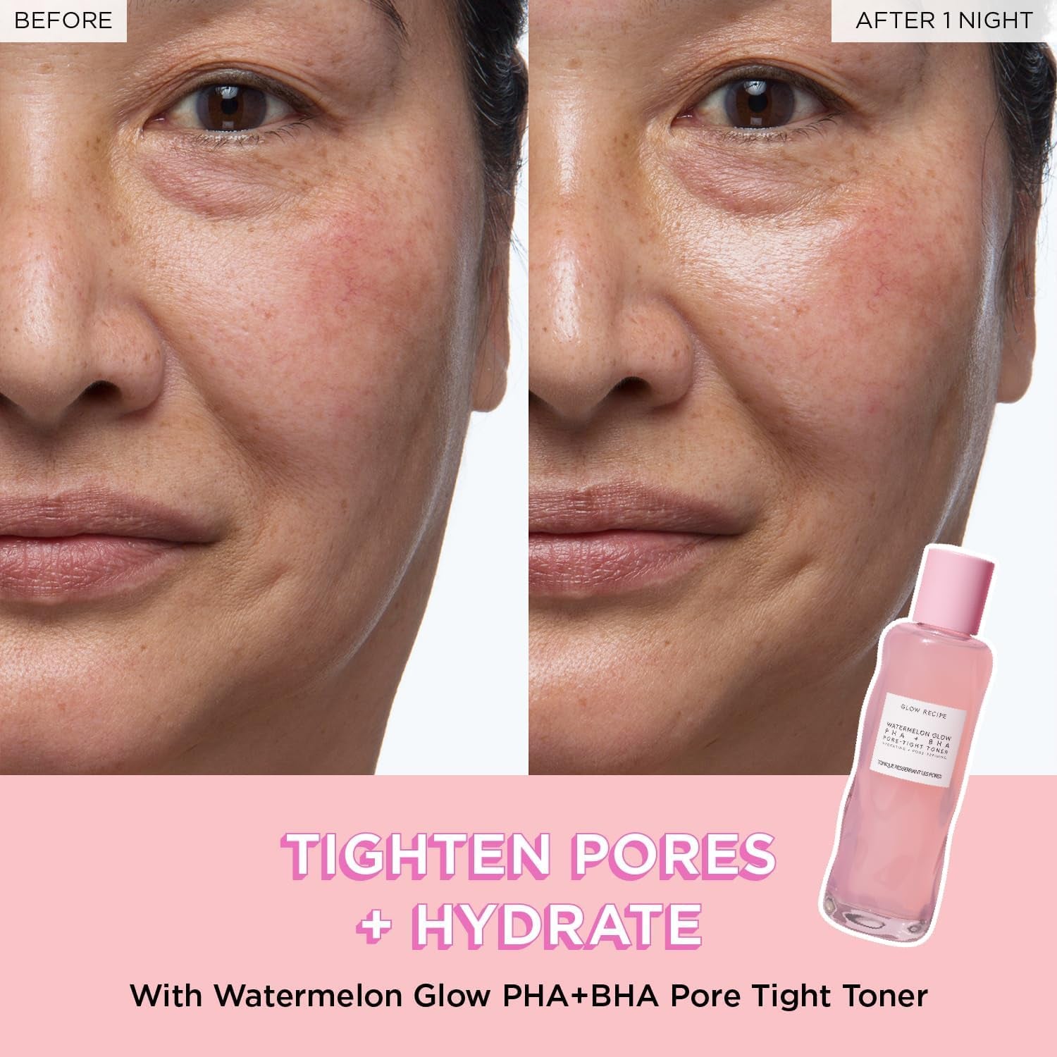 Watermelon Glow Icons Skin Care Gift Set - Niacinamide Dew Drops Face Serum (40Ml) + PHA + BHA Pore Minimizing Toner with Hyaluronic Acid (150Ml) + Pink Juice Facial Moisturizer (25Ml)